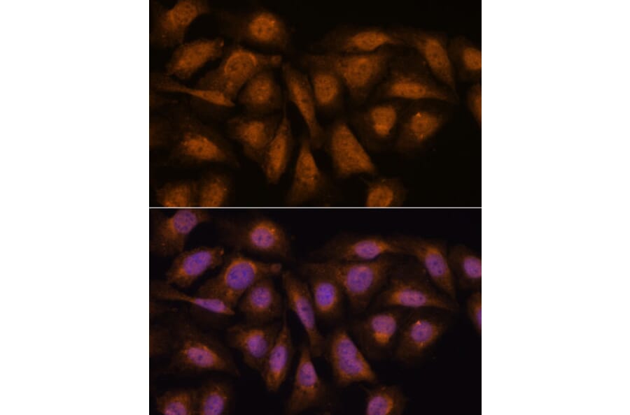 Immunofluorescence - Anti-PPP2R5D Antibody (A91220) - Antibodies.com
