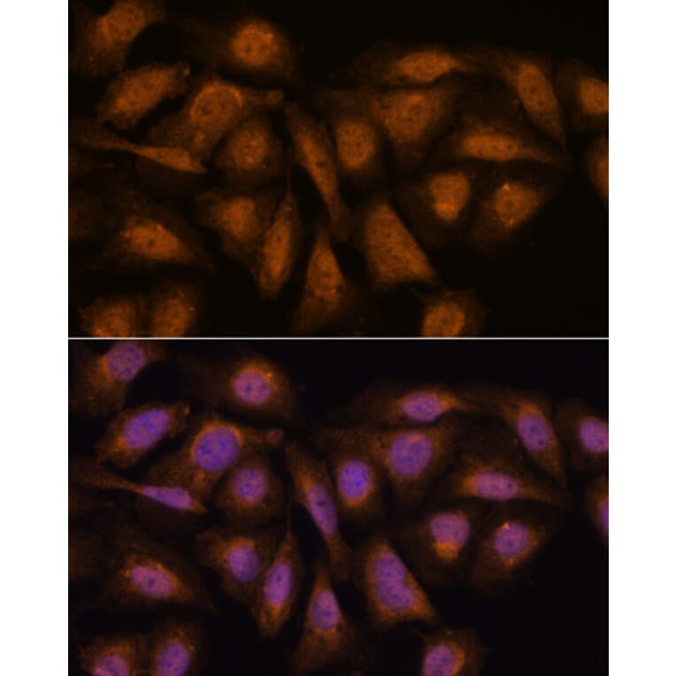 Immunofluorescence - Anti-PPP2R5D Antibody (A91220) - Antibodies.com