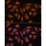 Immunofluorescence - Anti-PPP2R5D Antibody (A91220) - Antibodies.com