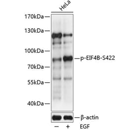 Western Blot - Anti-eIF4B (phospho Ser422) Antibody (A91222) - Antibodies.com