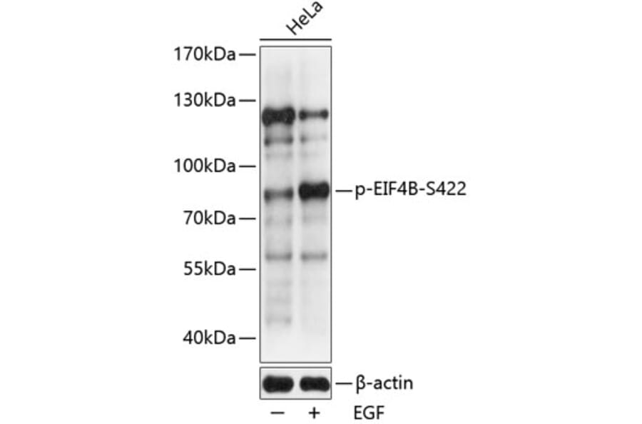 Western Blot - Anti-eIF4B (phospho Ser422) Antibody (A91222) - Antibodies.com
