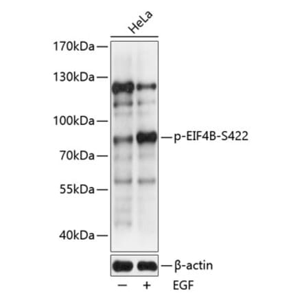 Western Blot - Anti-eIF4B (phospho Ser422) Antibody (A91222) - Antibodies.com