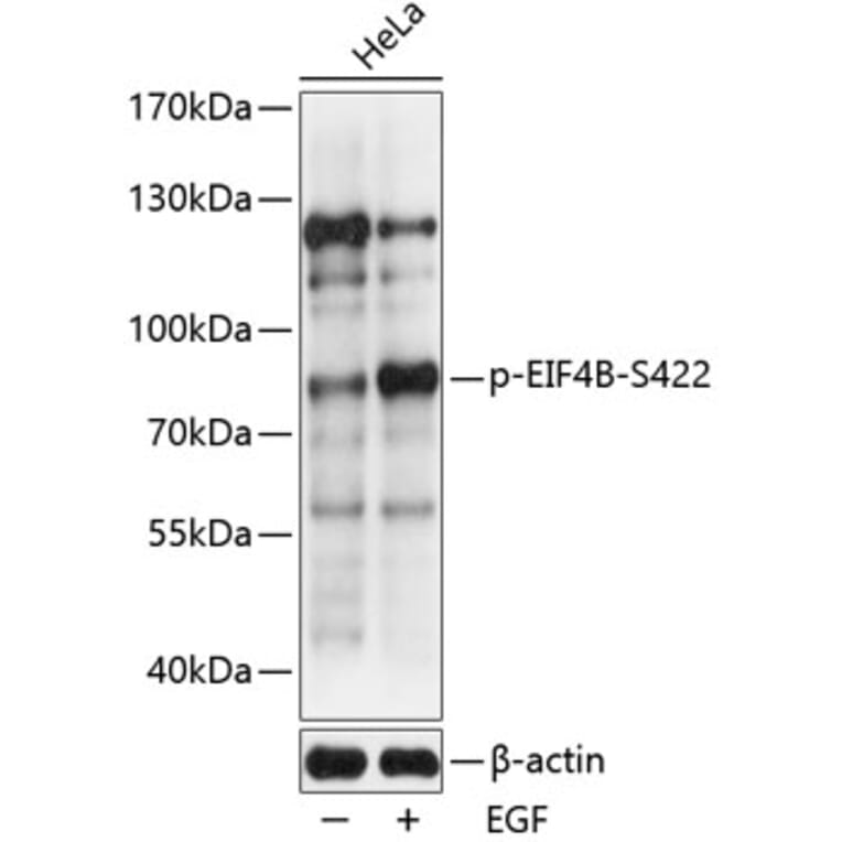 Western Blot - Anti-eIF4B (phospho Ser422) Antibody (A91222) - Antibodies.com