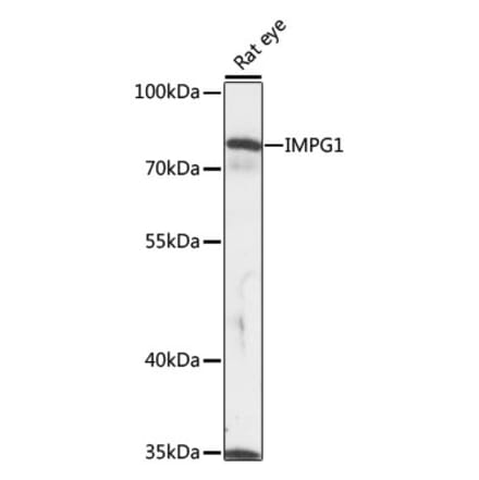 Western Blot - Anti-IMPG1 Antibody (A91224) - Antibodies.com