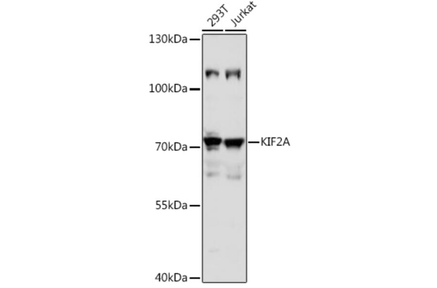 Western Blot - Anti-Kinesin Heavy Chain 2 Antibody (A91225) - Antibodies.com