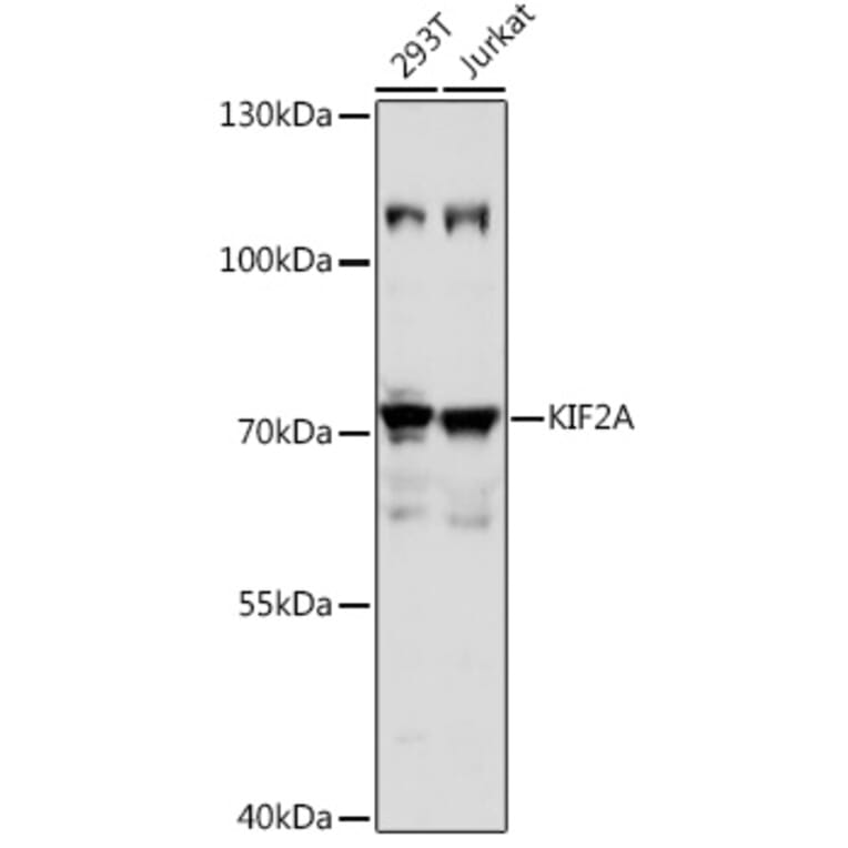 Western Blot - Anti-Kinesin Heavy Chain 2 Antibody (A91225) - Antibodies.com