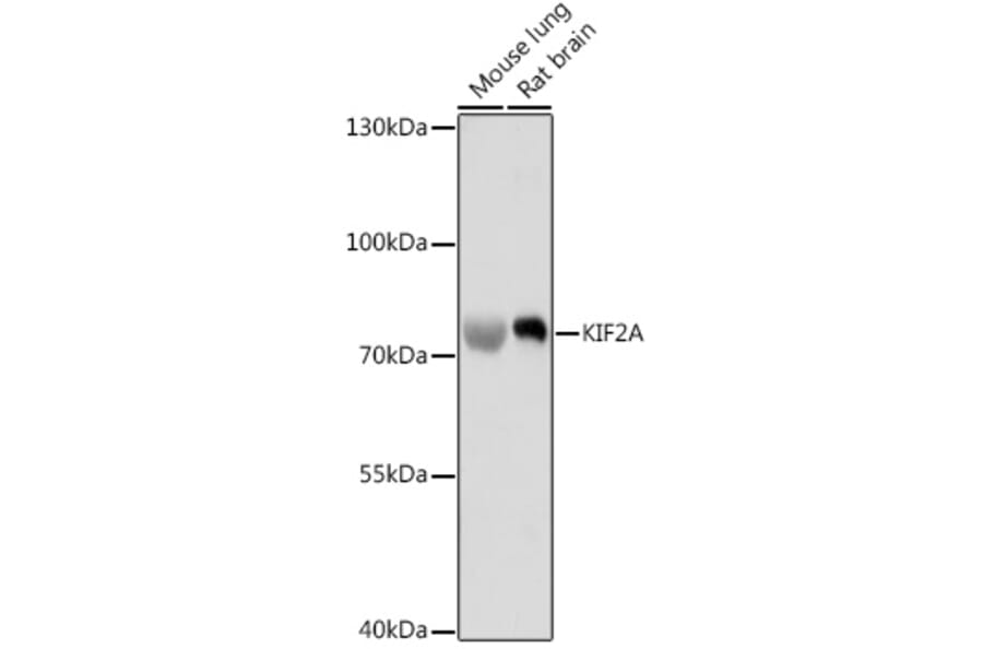 Western Blot - Anti-Kinesin Heavy Chain 2 Antibody (A91225) - Antibodies.com