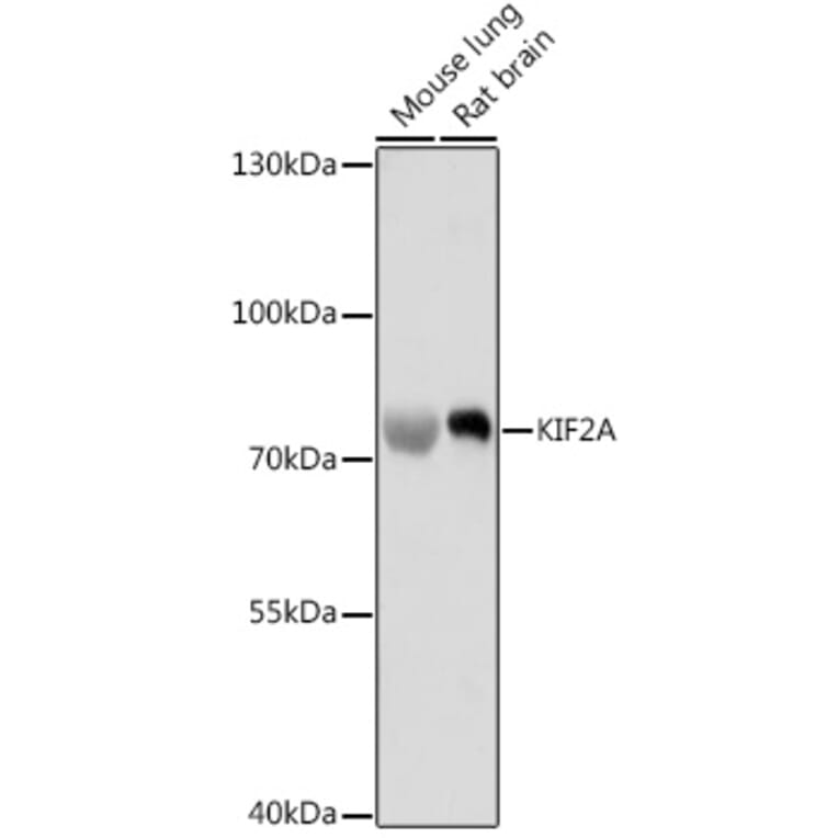 Western Blot - Anti-Kinesin Heavy Chain 2 Antibody (A91225) - Antibodies.com
