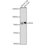Western Blot - Anti-Kinesin Heavy Chain 2 Antibody (A91225) - Antibodies.com