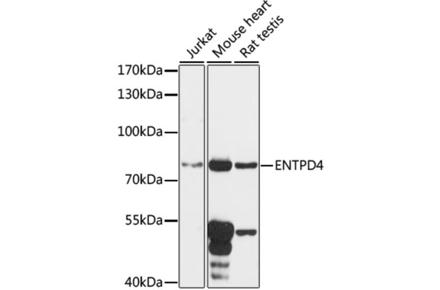 Western Blot - Anti-ENTPD4 Antibody (A91227) - Antibodies.com