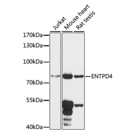 Western Blot - Anti-ENTPD4 Antibody (A91227) - Antibodies.com