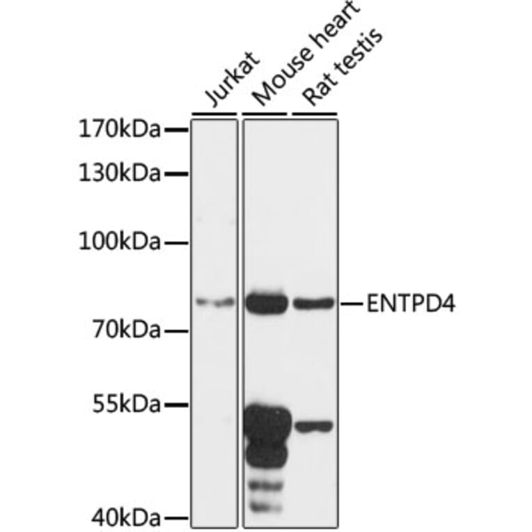 Western Blot - Anti-ENTPD4 Antibody (A91227) - Antibodies.com