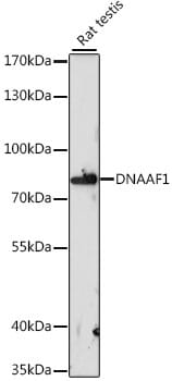 Western blot analysis of extracts of rat testis, using Anti-DNAAF1 Antibody (A16593) at 1:1,000 dilution.
Secondary antibody: Goat Anti-Rabbit IgG (H+L) (HRP) (AS014) at 1:10,000 dilution.
Lysates / proteins: 25µg per lane.
Blocking buffer: 3% non-fat dry milk in TBST.
Detection: ECL Basic Kit (RM00020).
Exposure time: 60s.