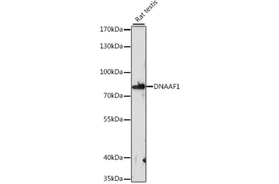 Western Blot - Anti-DNAAF1 Antibody (A91228) - Antibodies.com