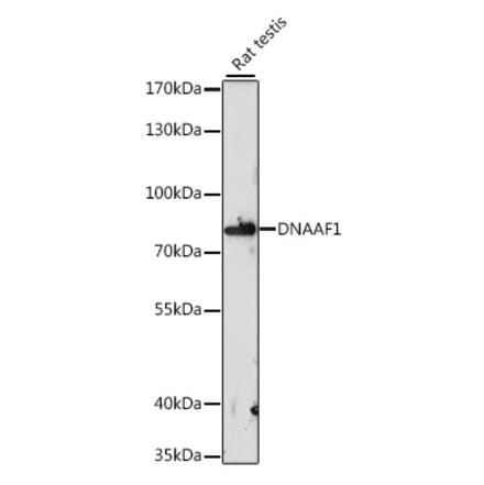 Western Blot - Anti-DNAAF1 Antibody (A91228) - Antibodies.com