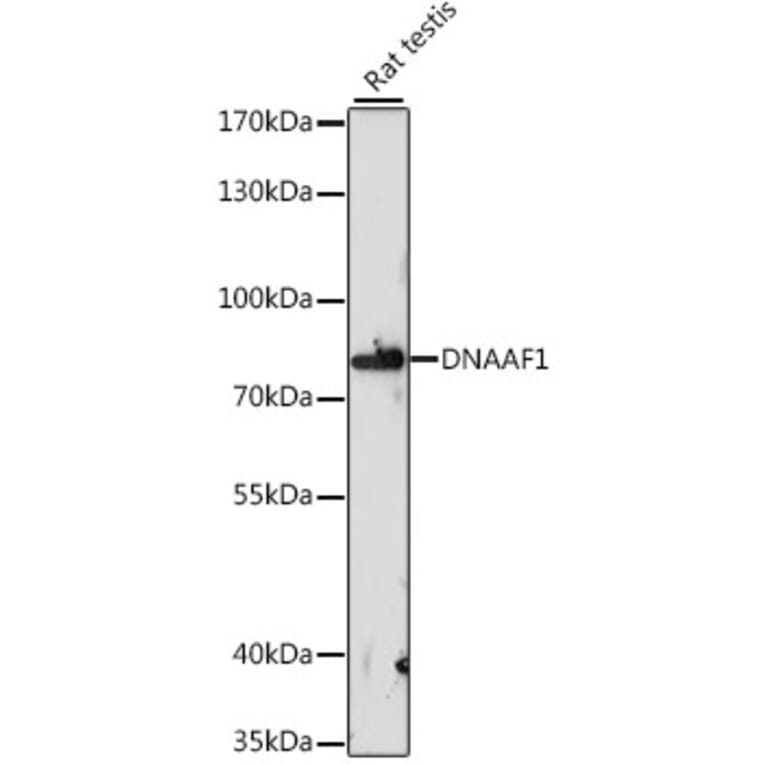 Western Blot - Anti-DNAAF1 Antibody (A91228) - Antibodies.com