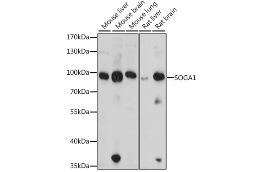 Western Blot - Anti-SOGA1 Antibody (A91229) - Antibodies.com