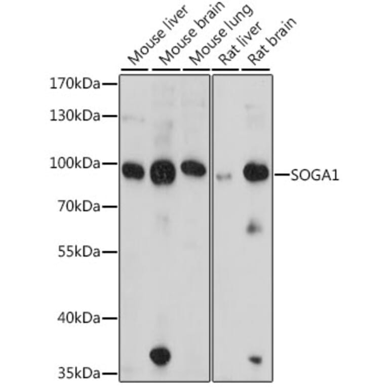 Western Blot - Anti-SOGA1 Antibody (A91229) - Antibodies.com