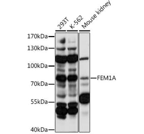 Western Blot - Anti-FEM1A Antibody (A91230) - Antibodies.com