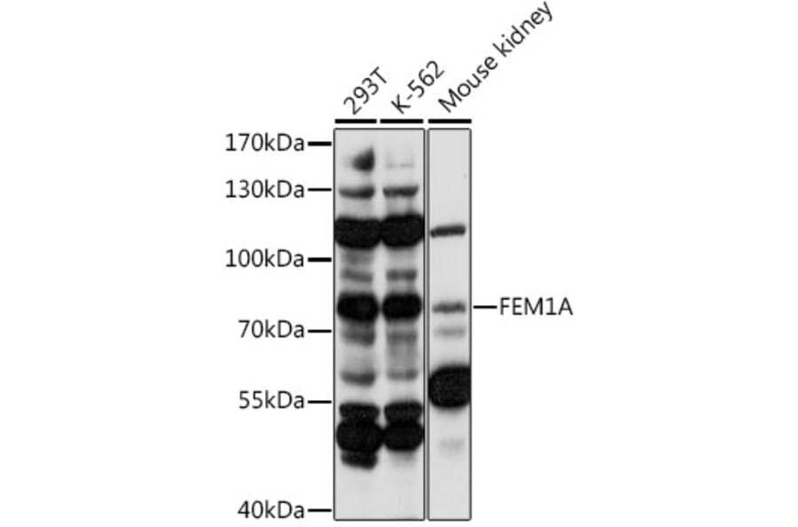 Western Blot - Anti-FEM1A Antibody (A91230) - Antibodies.com