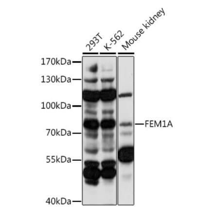 Western Blot - Anti-FEM1A Antibody (A91230) - Antibodies.com