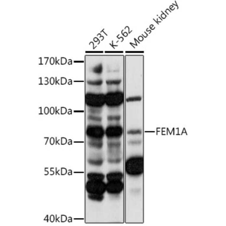 Western Blot - Anti-FEM1A Antibody (A91230) - Antibodies.com