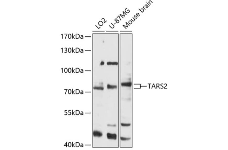 Western Blot - Anti-TARS2 Antibody (A91231) - Antibodies.com