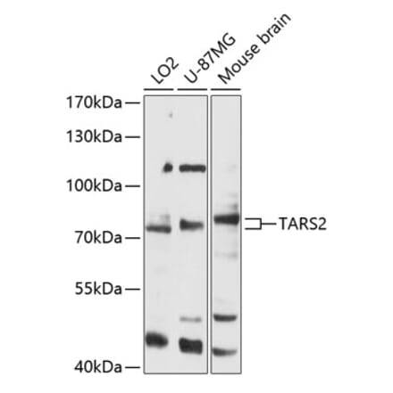 Western Blot - Anti-TARS2 Antibody (A91231) - Antibodies.com