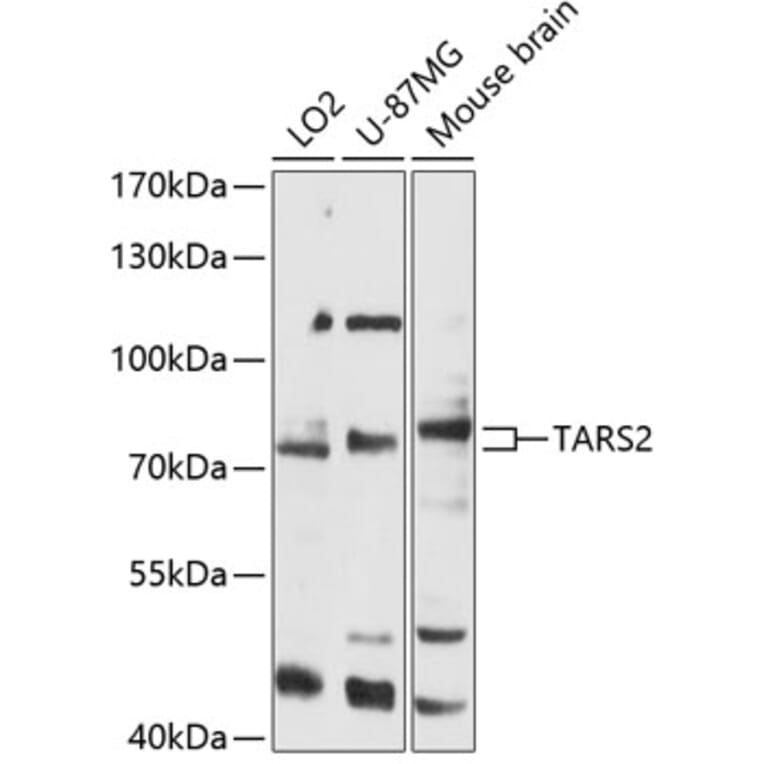 Western Blot - Anti-TARS2 Antibody (A91231) - Antibodies.com