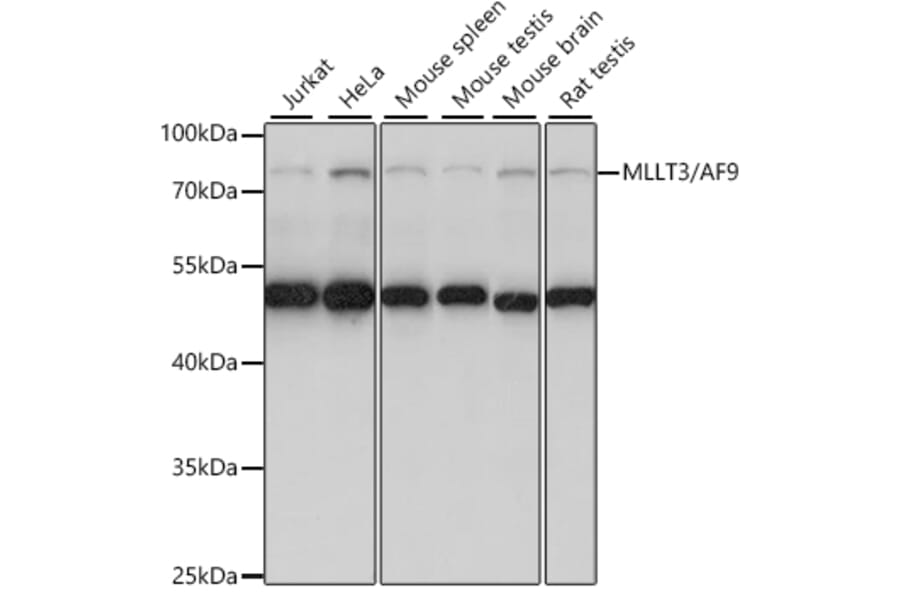 Western Blot - Anti-AF9 Antibody (A91232) - Antibodies.com