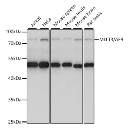 Western Blot - Anti-AF9 Antibody (A91232) - Antibodies.com