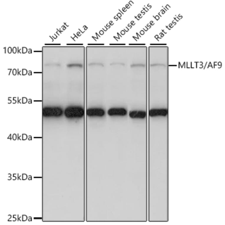 Western Blot - Anti-AF9 Antibody (A91232) - Antibodies.com