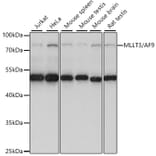 Western Blot - Anti-AF9 Antibody (A91232) - Antibodies.com