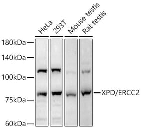 Western Blot - Anti-XPD Antibody (A91233) - Antibodies.com
