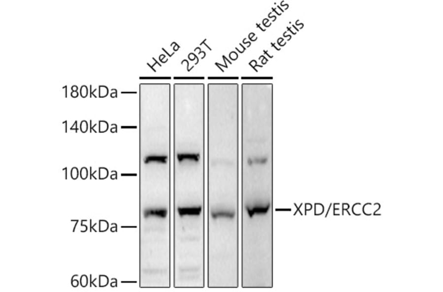 Western Blot - Anti-XPD Antibody (A91233) - Antibodies.com