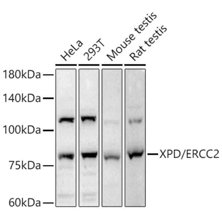 Western Blot - Anti-XPD Antibody (A91233) - Antibodies.com