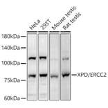 Western Blot - Anti-XPD Antibody (A91233) - Antibodies.com
