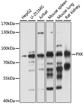 Western blot analysis of extracts of various cell lines, using Anti-PXK Antibody (A15458) at 1:1,000 dilution.
Secondary antibody: Goat Anti-Rabbit IgG (H+L) (HRP) (AS014) at 1:10,000 dilution.
Lysates / proteins: 25µg per lane.
Blocking buffer: 3% non-fat dry milk in TBST.
Detection: ECL Basic Kit (RM00020).
Exposure time: 10s.