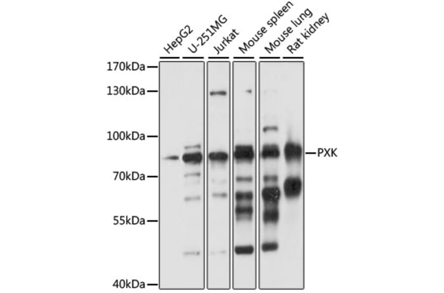Western Blot - Anti-PXK Antibody (A91236) - Antibodies.com