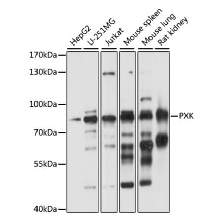 Western Blot - Anti-PXK Antibody (A91236) - Antibodies.com