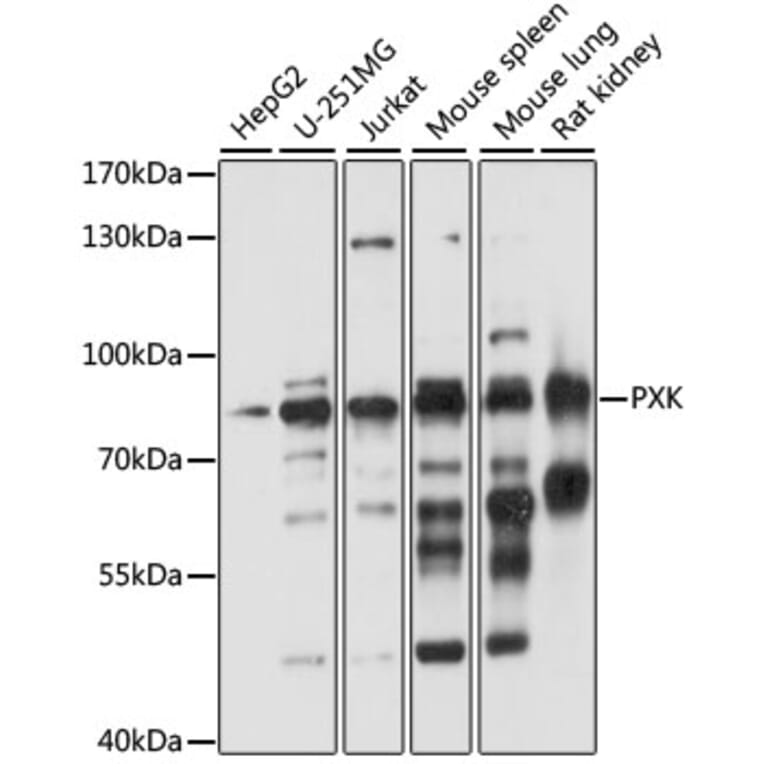 Western Blot - Anti-PXK Antibody (A91236) - Antibodies.com