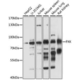 Western Blot - Anti-PXK Antibody (A91236) - Antibodies.com