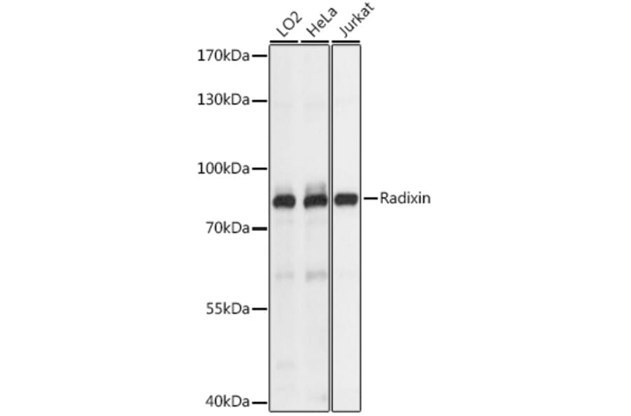 Western Blot - Anti-Radixin/RDX Antibody (A91237) - Antibodies.com