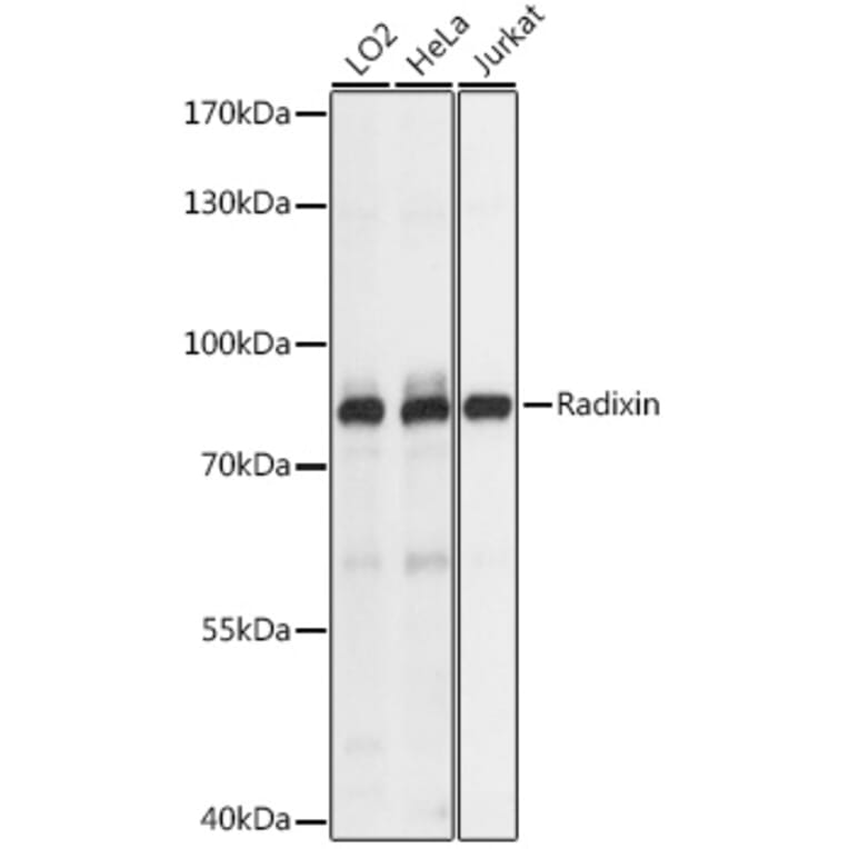 Western Blot - Anti-Radixin/RDX Antibody (A91237) - Antibodies.com