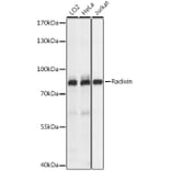 Western Blot - Anti-Radixin/RDX Antibody (A91237) - Antibodies.com