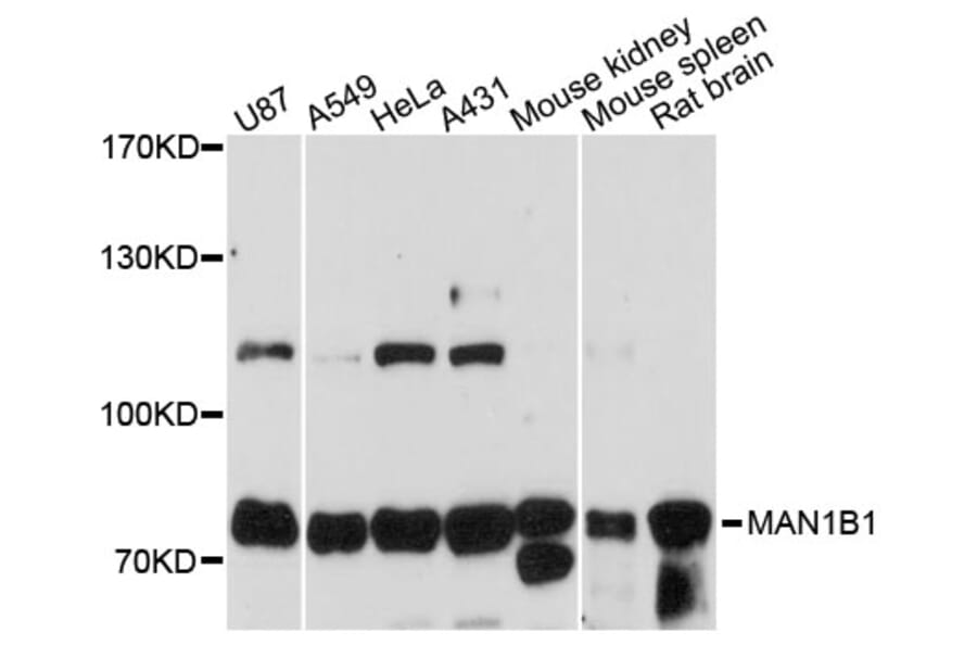 Western Blot - Anti-MAN1B1 Antibody (A13784) - Antibodies.com