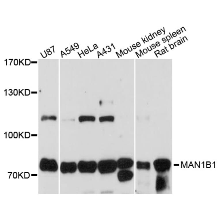 Western Blot - Anti-MAN1B1 Antibody (A13784) - Antibodies.com