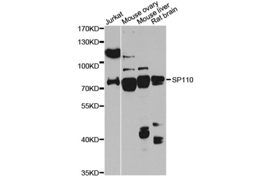 Western Blot - Anti-SP110 Antibody (A14003) - Antibodies.com