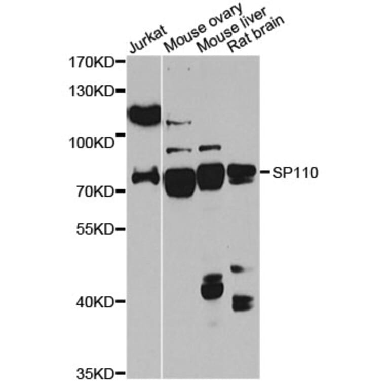 Western Blot - Anti-SP110 Antibody (A14003) - Antibodies.com