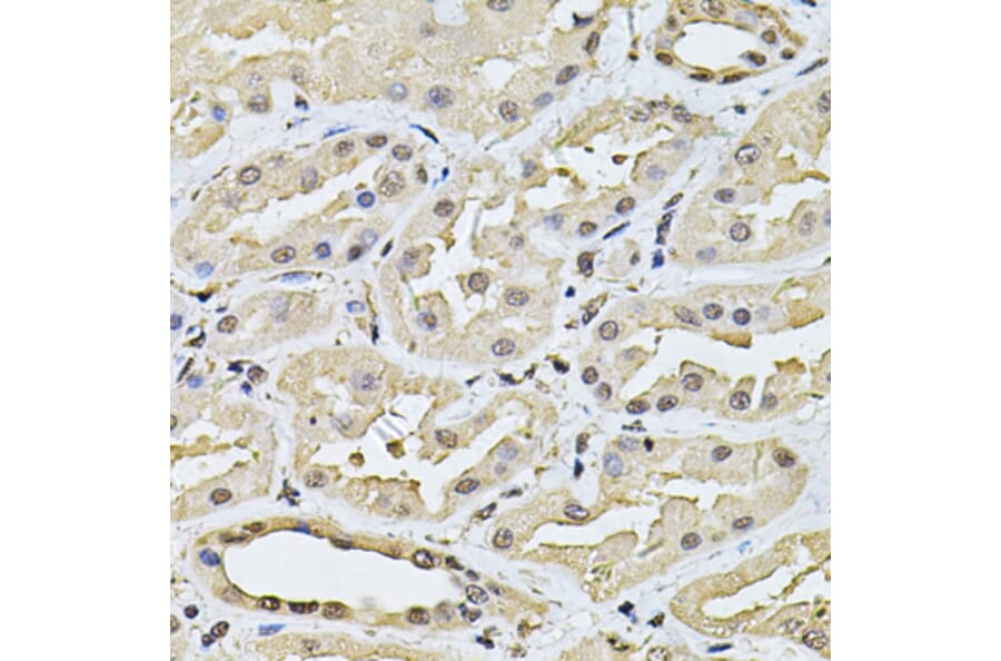 Immunohistochemistry - Anti-SP110 Antibody (A14003) - Antibodies.com